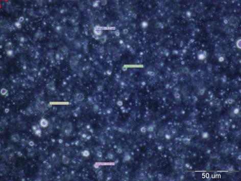 Photograph optical microscopy of experimental formulation RDES2