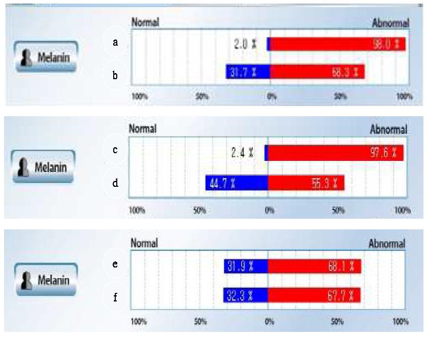 Graph comparison of melanin analysis before and after treatment sample.