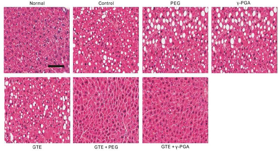 Fig. 5. Histopathological changes in the liver induced by acute ethanol administration