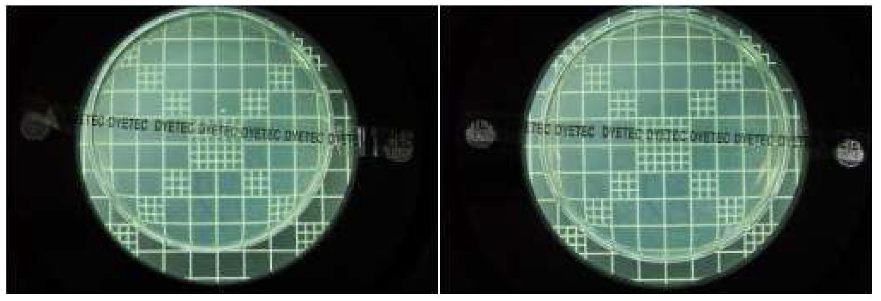 [Fig 11. Staphylococcus aureus - #1(좌), #2(우) ]