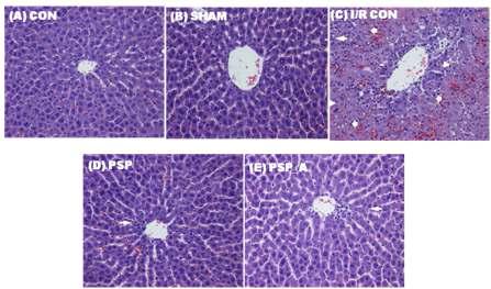 Effect of purple sweet potato extract liver damage on hepatic I/R rats.