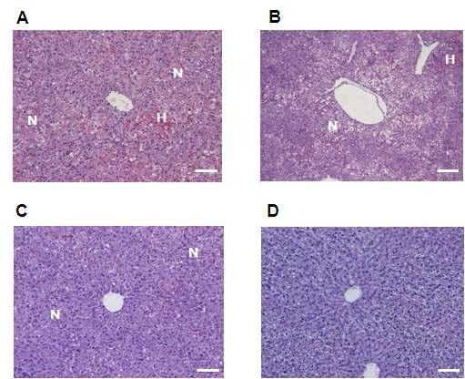 Effects of A E and A A pretreatment on histopathologic changes in W istar rats injected with D-GalN/LPS