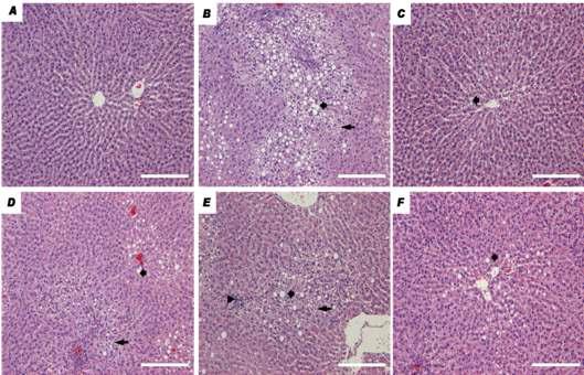 Effects of ethanol extract of Acanthopanax koreanum N akai onhepatic histopathologic changes in alcohol induced hepatic damage on SD rats.