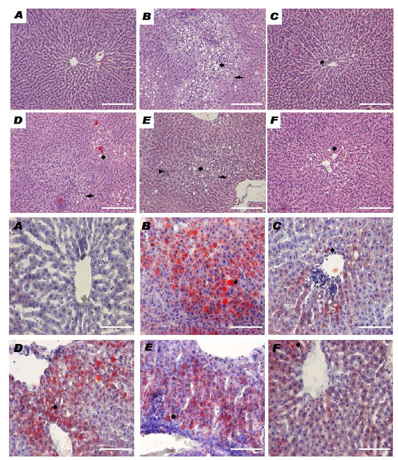 Effects of ethanol extract of Acanthopanax koreanum N akai onhepatic histopathologic changes in alcohol induced hepatic damage on SD rats