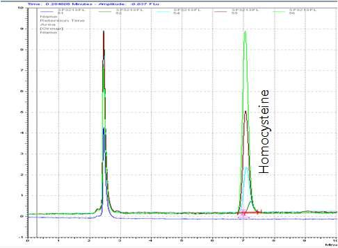 Chromatogram of homocysteine standard peaks