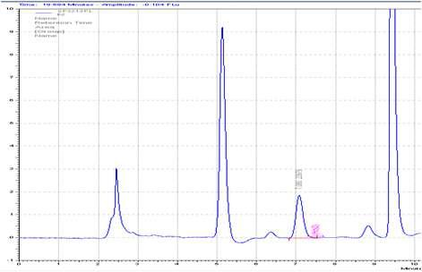 Chromatogram of homocysteine in plasma sample peaks