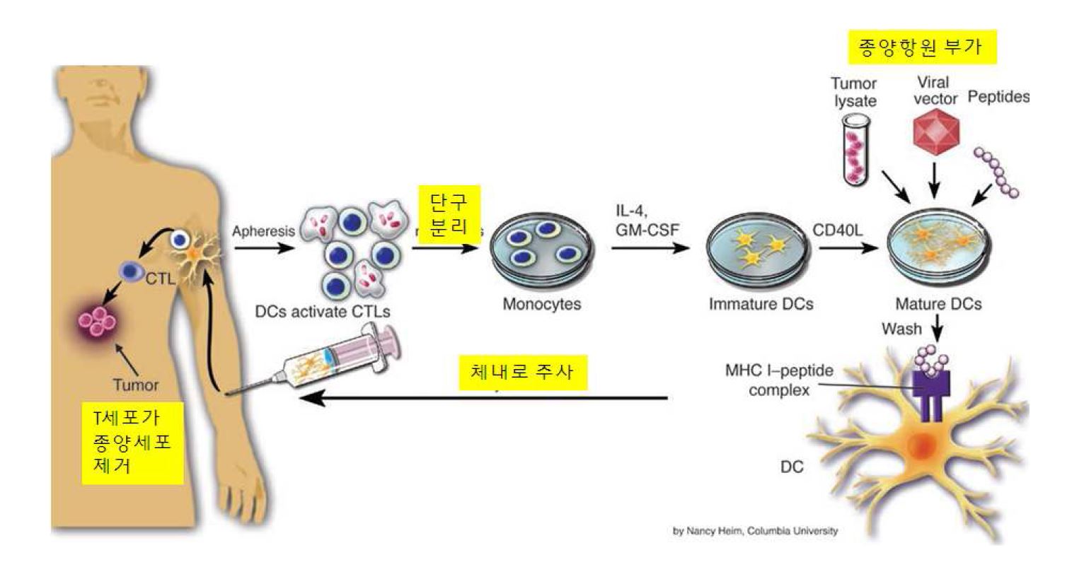 수지상세포를 이용한 암면역치료요법의 기본 개념