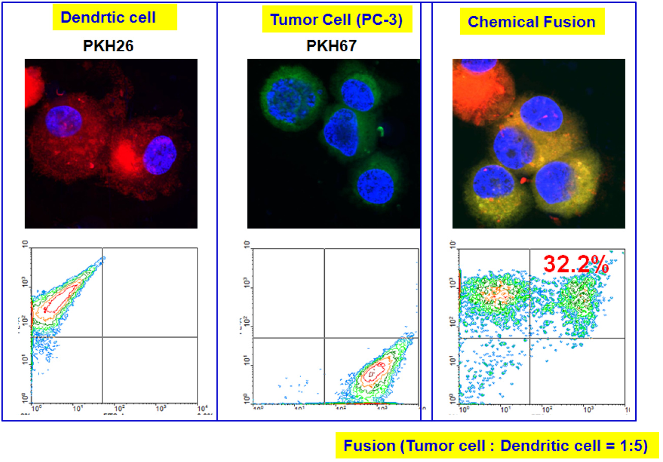 전립선암에서 수지상세포를 이용한 세포치료법을 확립하기 위해서, 전립선암 세포주인 PC-3를 polyethylene glycol을 이용하여 수지상세포에 융합(fusion)하는 연구를 수행하였으며, 그 효율이 32.2% 정도를 보여주고 있음