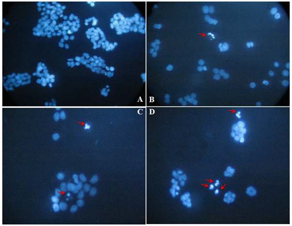 Fig. 37. The apoptosis effect of GEs using DAPI staining. The panel shows arepresentative 4`,6-diamidino-2-phenylindole (DAPI) staining of HT29 cells after 24 htreatment with GEs using 100 μg/ml high concentrations.Red arrows point to apoptotic bodies with condensed chromatin typical of cells undergoingapoptosis were observed by fluorescence microscopy