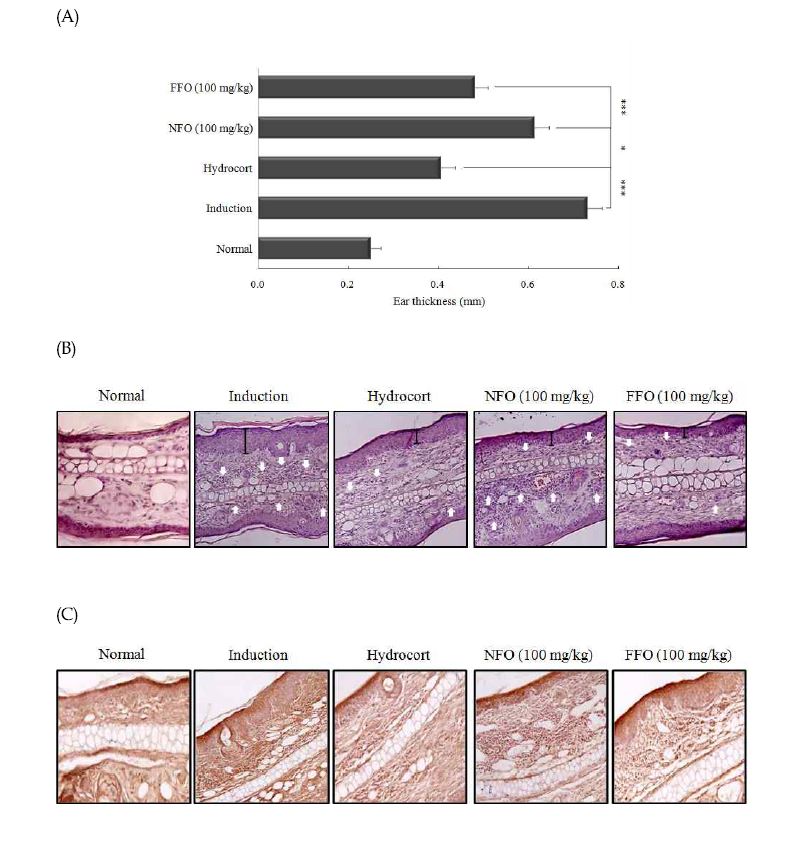 Figure 16. Histological features of ear tissue and TSLP hyperproduction in DNCB-challenged mice