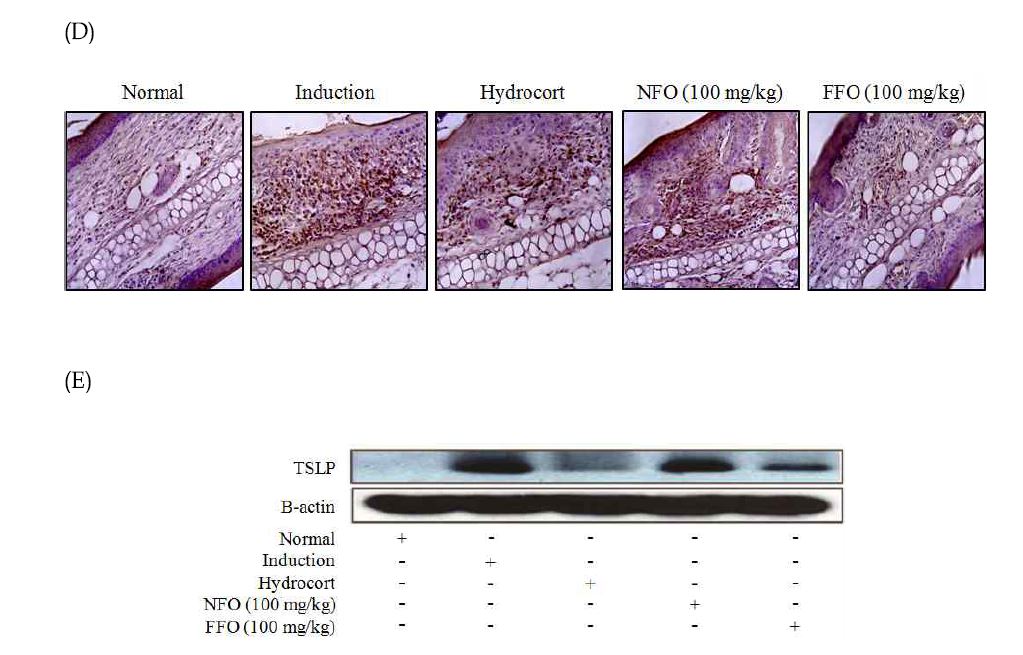 Figure 16. Histological features of ear tissue and TSLP hyperproduction in DNCB-challenged mice