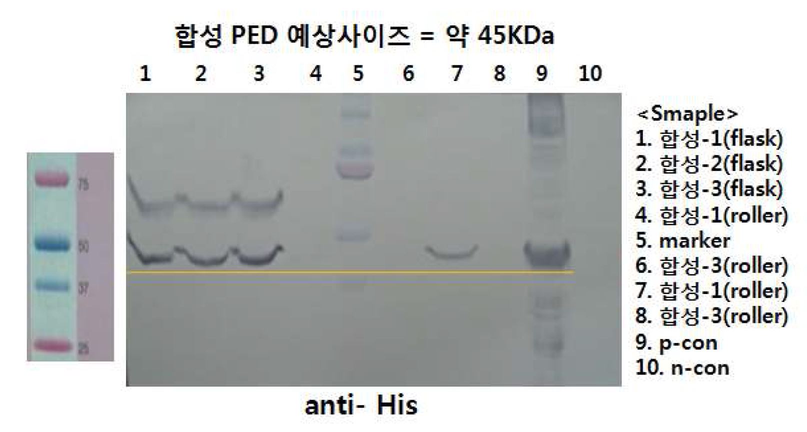 그림 9. 곤충 세포 내 재조합 바이러스 벡터 도입 및 발현 검정