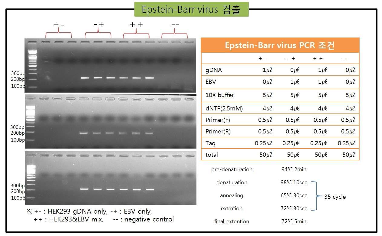 EBV virus의 검출