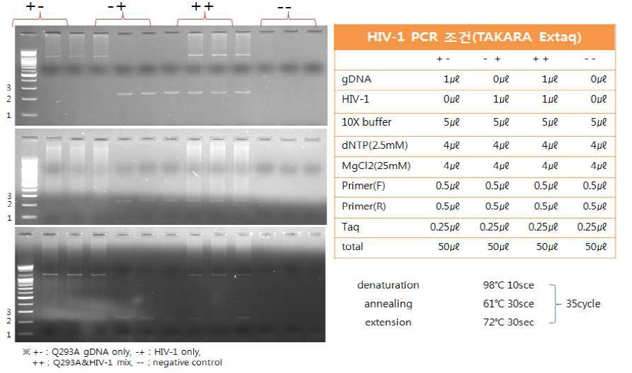 PCR법을 이용한 HIV-1 바이러스의 검출