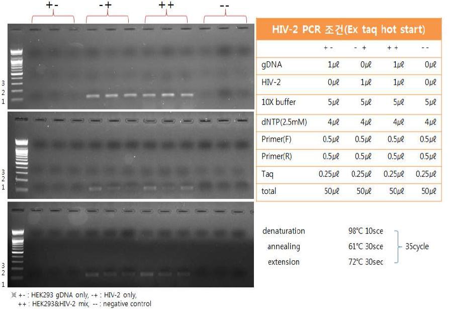 PCR법을 이용한 HIV-2 바이러스의 검출