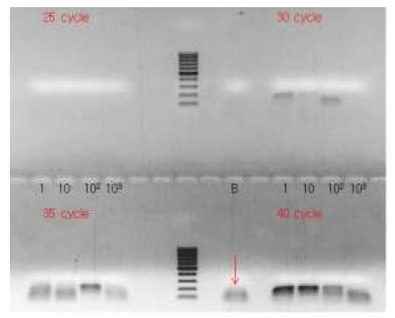 Semi-quantitative PCR방법과 TBE-agarose 전기영동방법을 통한 분석 결과