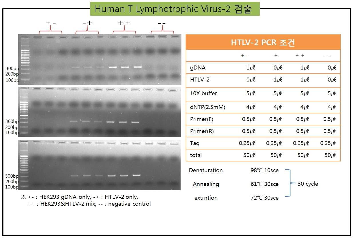 HEK293 genomic DNA에 존재하는 HTLV-2 오염의 PCR 검출방법