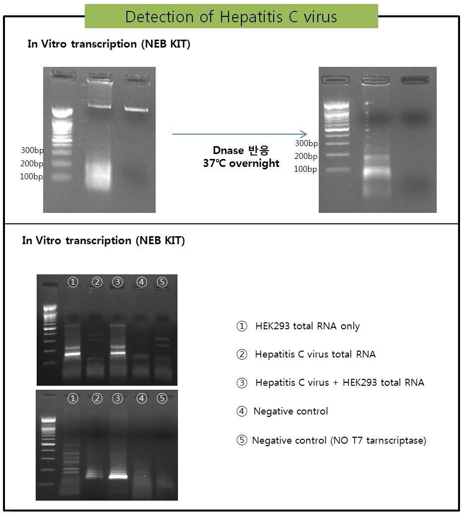 Reverse-transcriptase PCR법을 이용한 HCV의 검출