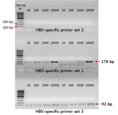 각 PCR primer set의 HBV 검출한계 분석결과