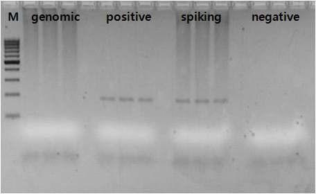 Biologics 중 하나인 HEK293 genomic DNA spiking 조건에서의 HBV 검출한계 시험결과
