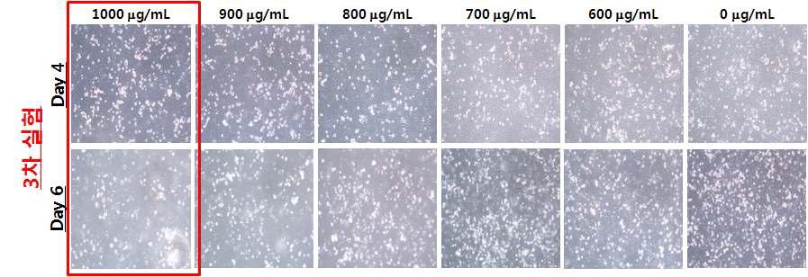 G418 (600 ~ 1000 μg/mL)을 이용한 A549세포의 항생제 내성 test