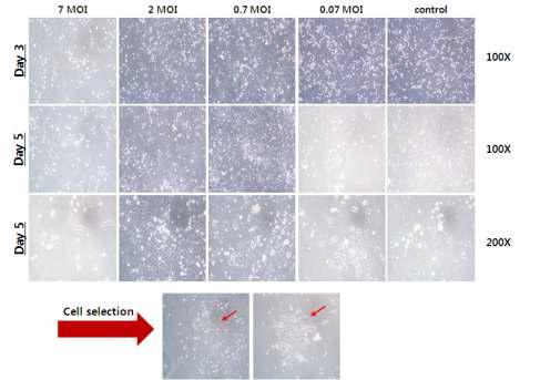 Lenti-MCS2와 lenti-E1b vector를 co-infection한 후 puromycin과 G418 항생제를 처리한 결과 (실험조건 1)