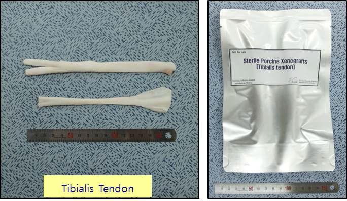 방사선 이용 기술과 α-galactosidase처리, 천연 가교제처리를 병용하여 제조한 안전성이 증가된 파열인대 재건용 이종조직(Tibialis tendon)