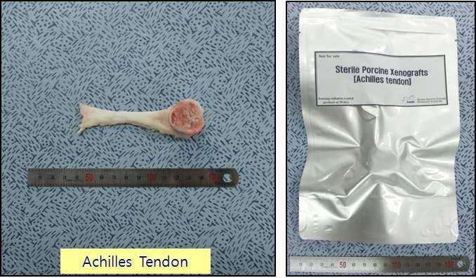 방사선 이용 기술과 α-galactosidase처리, 천연 가교제처리를 병용하여 제조한 안전성이 증가된 파열인대 재건용 이종조직(Peroneus longus tendon)