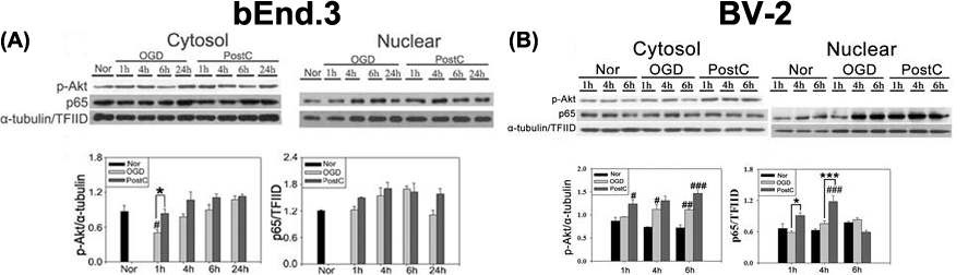 그림 3. I n vitro에서 postconditioning 후 Akt/NF-κB 활성 증가