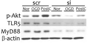 그림 8. siTLR5에 의한 MyD88 및 활성형 Akt의 감소