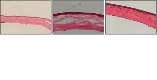 그림 4. 양성대조군에 비해서 중간엽줄기세포 처리군에서 염증세포가 억제되고, 각막상피층의 배열도 일정하여짐이 관찰되었다.