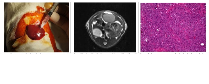 그림. SD 쥐의 간에 McA-RH7777 세포주를 주입하고 (좌), 2주 후 종양생성을 MRI 로 확인하였다 (가운데). 이 종양은 조직학적으로 인간의 간세포암과 유사항 trabecular pattern을 보였다 (우).