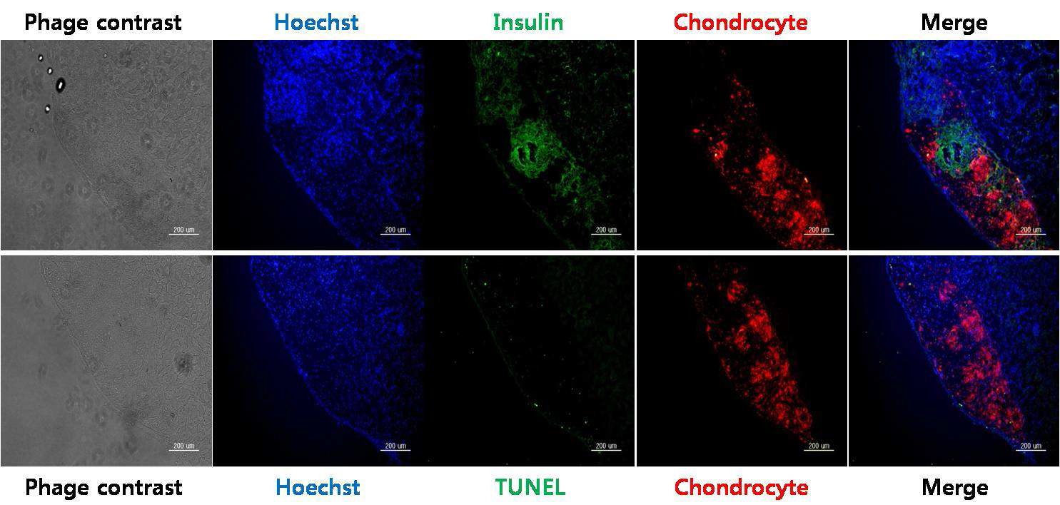 그림 5 Xeno-model의 CMIDIS-islets을 마우스의 신장 피막하에 이식한 후 20일 뒤 회수하여 insulin 면역 형광 염색을 시행한 사진, 200X)