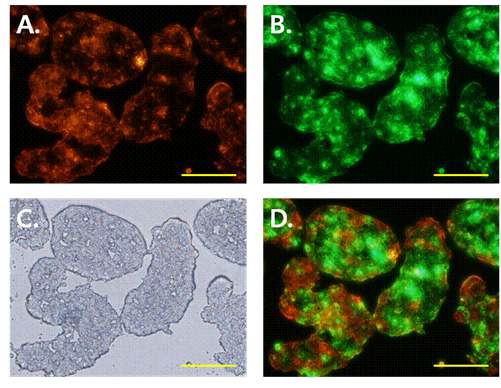 그림 6 혼합 세포복합체의 각 세포주의 분포 모습 (동결절편)