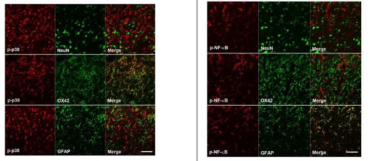 그림 2. p38 MAPK와 NF-kB의 colocalization