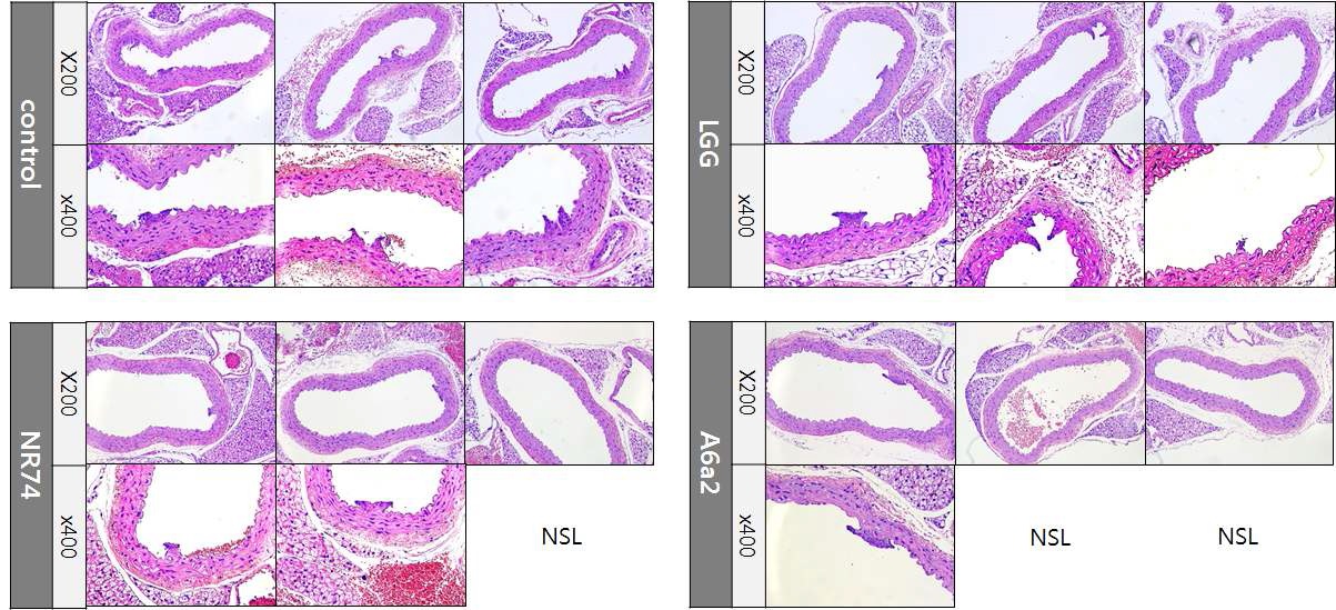 그림 19 STZ와 고콜레스테롤 식이를 이용한 동맥경화 유도 쥐의 동맥 단면을 H&E staining한 사진.