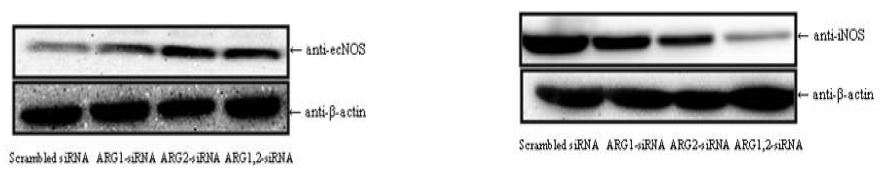 Fig. 3. ecNOS and iNOS expression by knockdown of arginase 1,2-siRNA in transfected HUVEC cell lines.+, cells exposed to the indicated agent; -, nonexposed. The values were quantified as 5 independentexperiments and the representative image was shown