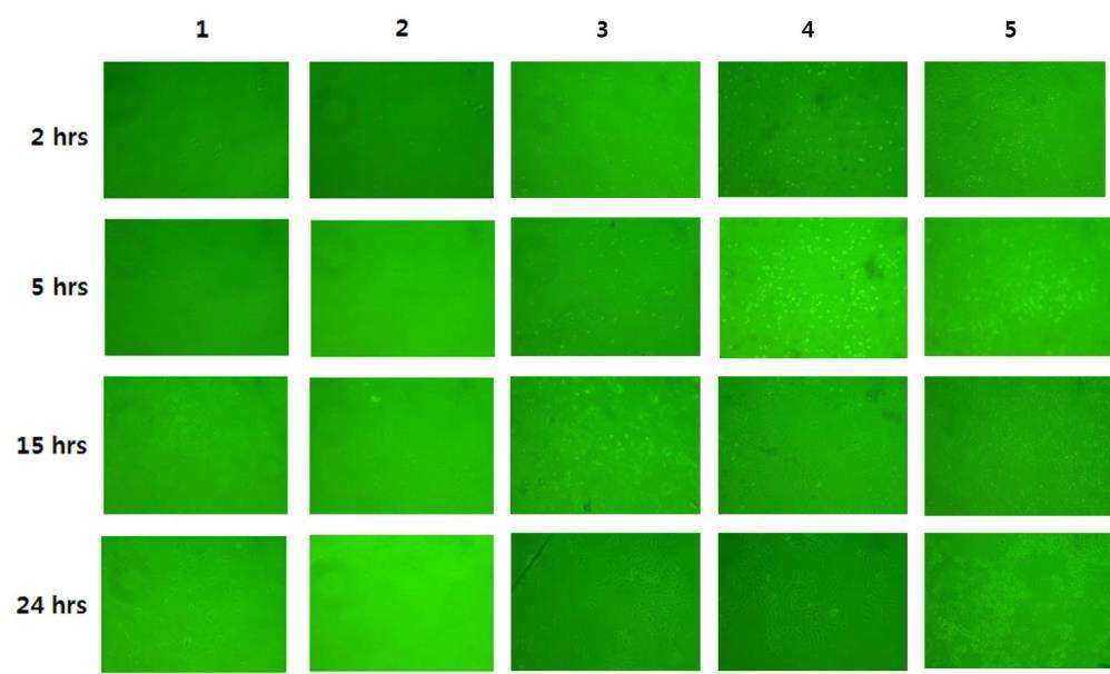 Fig. 2. Microscopic view of HUVEC plated on different matrixes