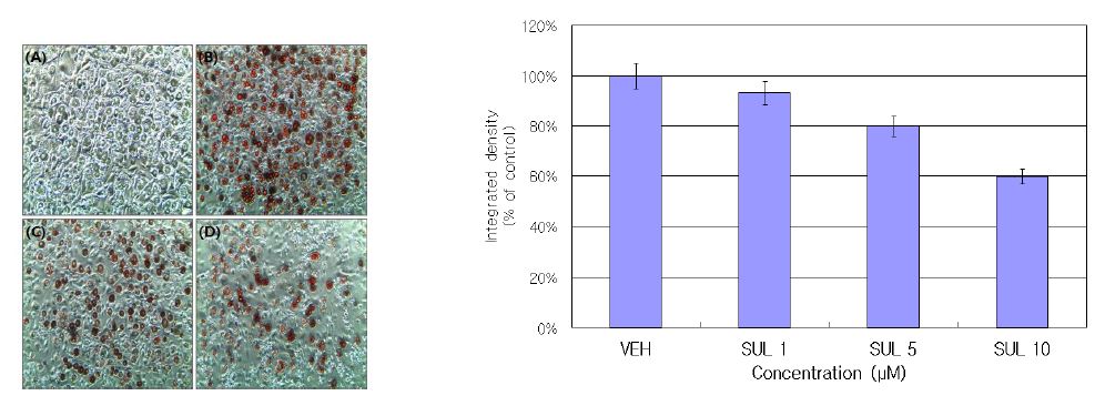 그림 1. 농도별 Sulforaphane 처리가 지방세포형성과정에 미치는 영향