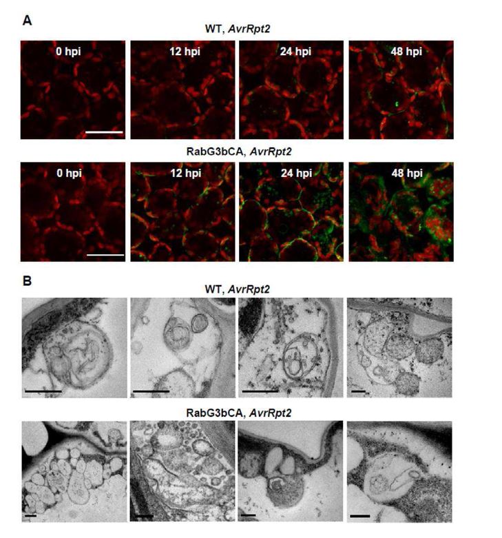 그림 15. A utophagic structures are formed in W T and more abundantly in RabG3bCA plants following P st D C3000 (AvrR pt2) infection