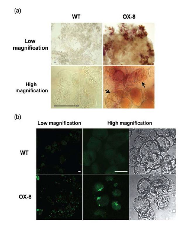 그림 6. Lignification of secondary walls and autophagic induction in RabG3bCA-cultured cells