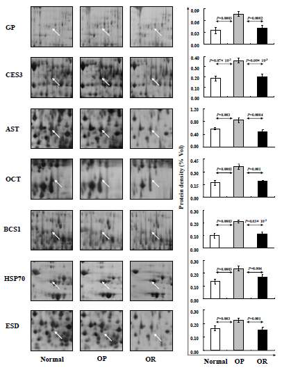 Significantly increased liver proteins in OP rats compared to control and OR rats. Zoom-in-gel images of each protein are shown with their average expression levels in three rats in each group. Data are presented as mean values ±SEM. of volume density (%) of target spot in each group. They were estimated using the ANOVA test and the p values represent the significance of expression level between each group.