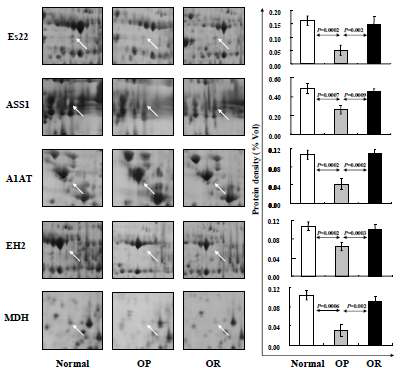 Significantly decreased liver proteins in OP rats compared to control and OR rats. Zoom-in-gel images of each protein were shown with their average expression levels in three rats in each group. Data are presented as mean values ±SEM of volume density (%) of target spot in each group. They were estimated using the ANOVA test and the p values represent the significance of expression level between each group.