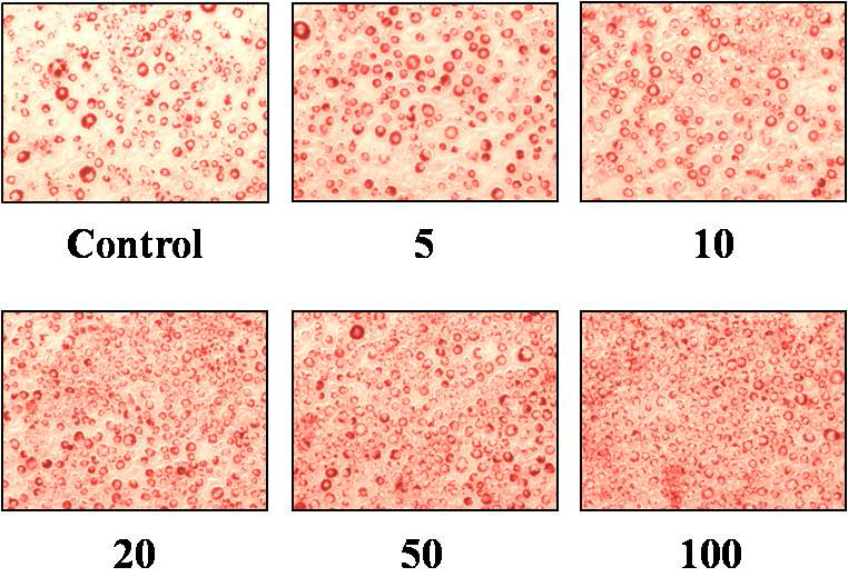 . Cells were treated with various concentrations of MC (5, 10, 20, 50 and 100 μg/ml) under the condition of differentiation induction and then lipid droplets were stained by Oil Red O. Magnification, 200X.