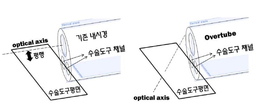 내시경 카메라의 In-line vision 문제를 해결하기 위한 optical axis 의 각도 조절