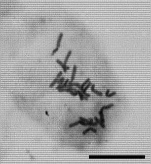 Chromosomes of Isoetes laosiensis (2n = 22, scale bar = 10 ㎛; unpublished data).