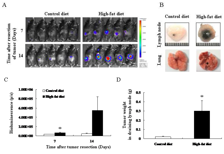 B16-F10 allograft model에서 고지방식이의 공급은 암세포의 림프절 전이를 촉진시킴.