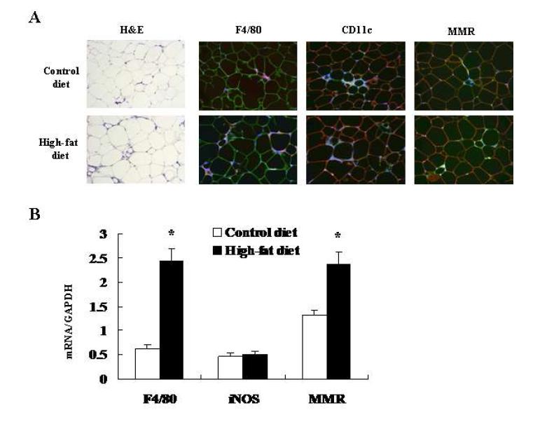 고지방식이가 B16-F10 세포주입 후 지방조직에서의 macrophage polarity 에 미치는 영향