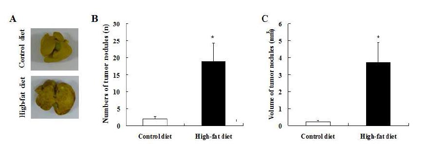 4T1 orthotopic model에서 고지방식이 (60 kcal% fat)가 간 전이에 미치는 영향.