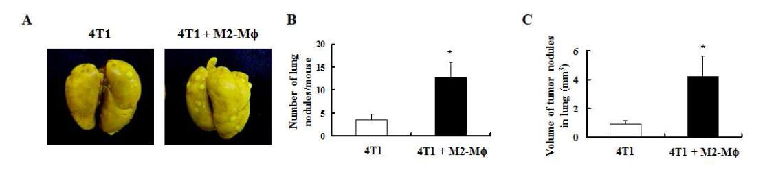 4T1 종양의 폐전이에 M2-MΦ가 미치는 영향.